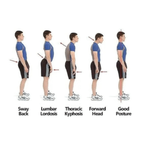 Posture Correction